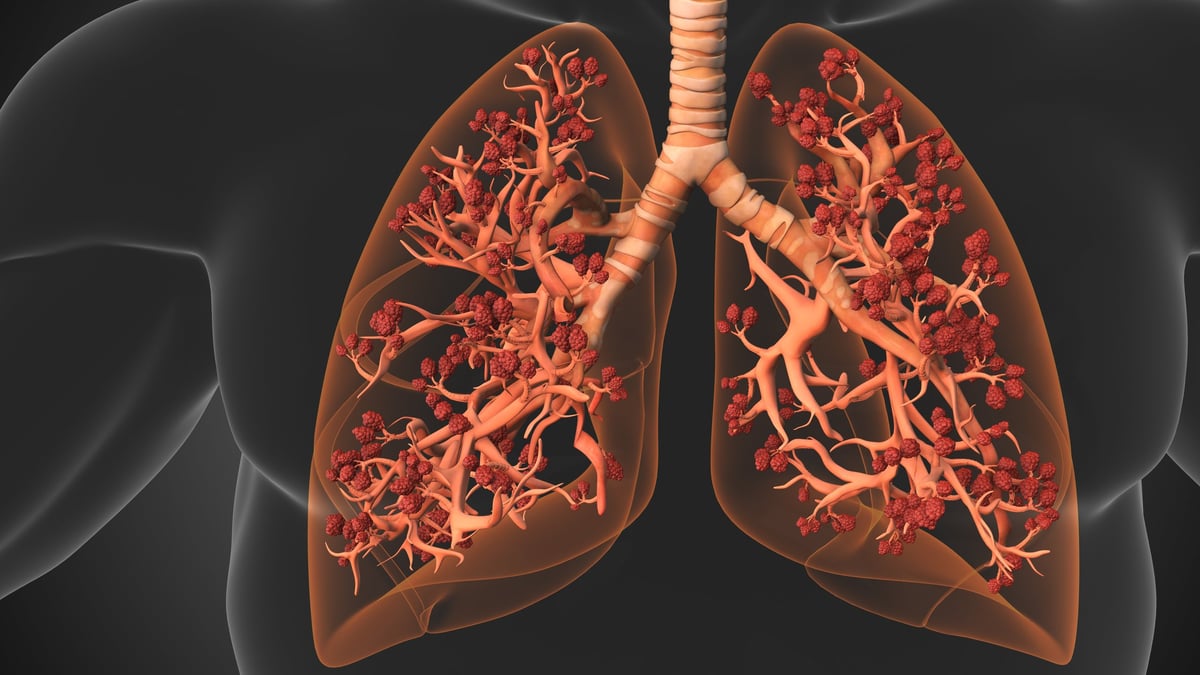 The alveoli are where the lungs and the blood exchange oxygen and carbon dioxide during the process of breathing in and breathing out.