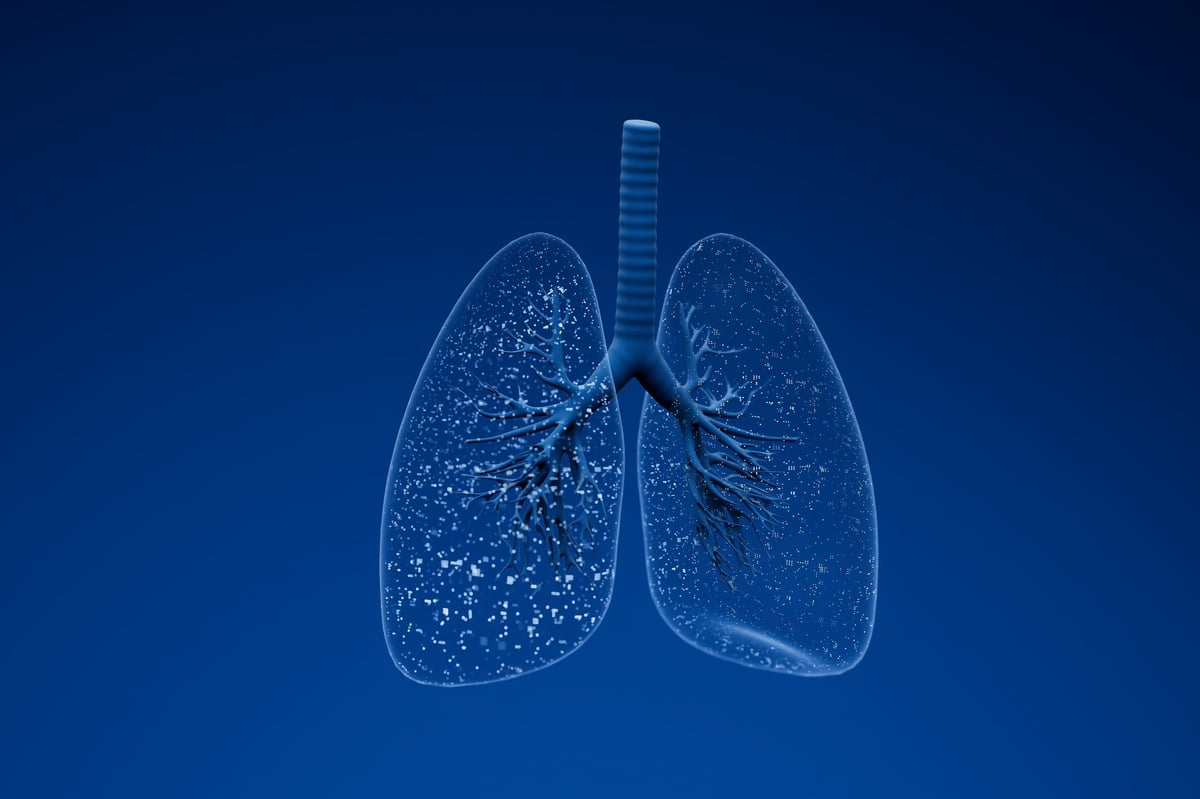 Modelo anatómico de pulmones mostrando bronquios y alvéolos